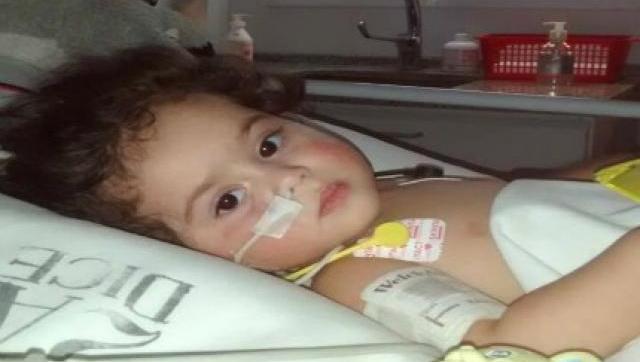 Le dieron el alta a Luciana, la siamesa separada en el Hospital Posadas