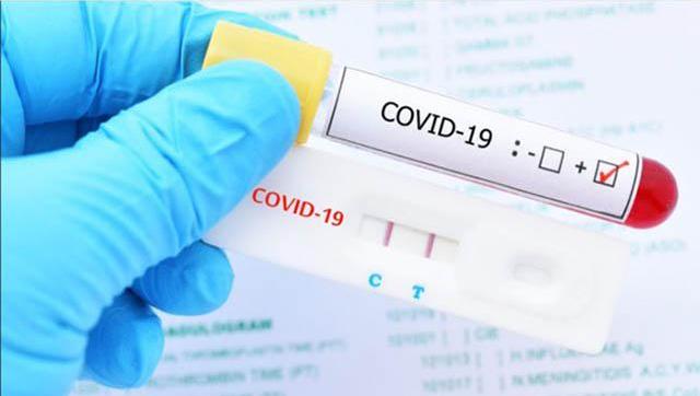 Situación y casos de Coronavirus al 3 de diciembre en Morón